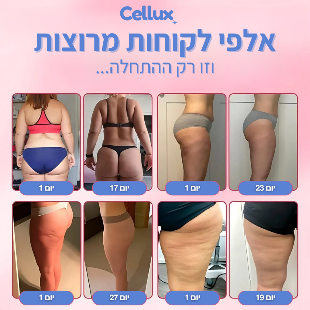 מכשיר עיסוי Cellux נגד צלוליט