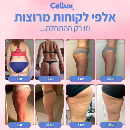 מכשיר עיסוי Cellux נגד צלוליט